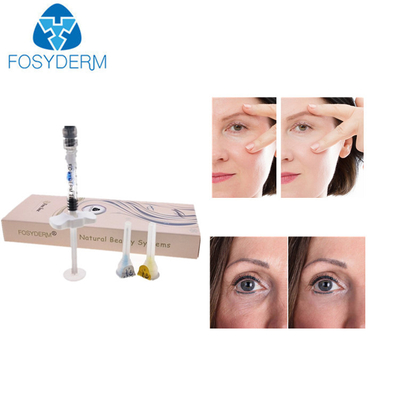 Göz Kırışıklığı Hyaluronik Asit Dermal Dolgu Yüz Kırışıklıkları Enjeksiyon Dolgu