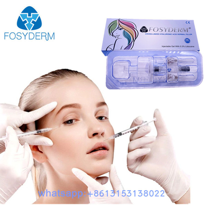 24 Mg/Ml Fosyderm Facial Filler HA Dermal Filler Hyaluronik Asit Jel Enjeksiyonları