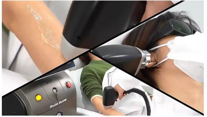 Güçlü Yeni 808nm Ice Diodo Trio 3 Wave Diode Laser 810nm Depilation 808 Nm Saç çıkarma 3 Waves Titanyum Medical Machi 2