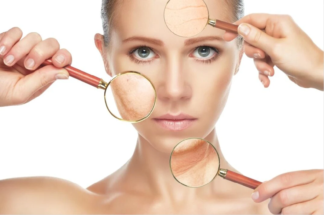 Hyamely Hyaluronic Acid Meso Solution Dermal Filler Mesoterapide cilt bakımı için serum 0