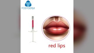 kırmızı dudaklar