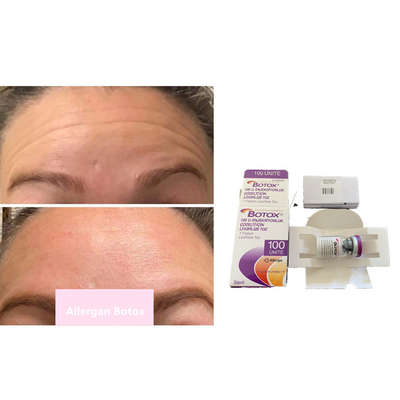 Kırışıklık Giderme 100 Adet Allergan  Botulinum Toksin Toz Enjeksiyonu