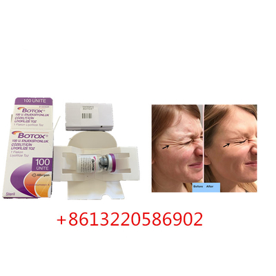 Yaşlanma Karşıtı Allergan  Enjeksiyonu 100 Adet Tip A Kırışıklık Karşıtı
