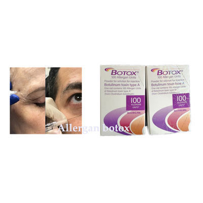 Kırışıklık Kaldırmak İçin Botulinum Toksin Allergan  Enjeksiyonu