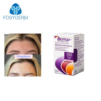 Allergan Botulinum Toksin Enjeksiyonları Kırışıklıkları Giderir 100 Ünite Botoks