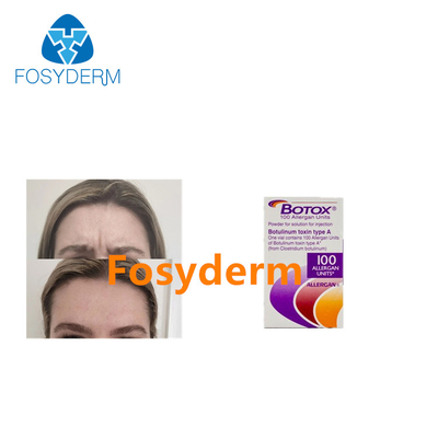Allergan Botulinum Toksin Enjeksiyonları Kırışıklıkları Giderir 100 Ünite Botoks