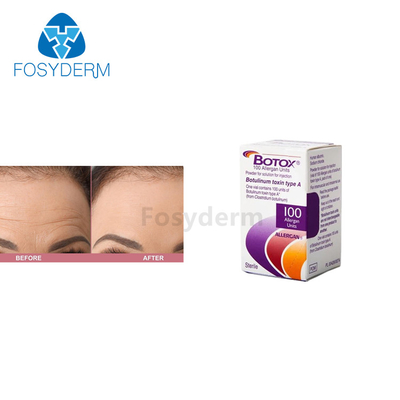 100 Adet Allergan  Kırışıklık Karşıtı Botulinum Toksin Enjeksiyonu