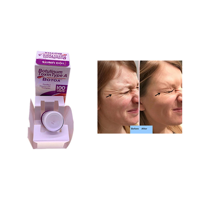 Kırışıklıklar Kaldırma Dermal Dolgu Enjeksiyonu İçin  Allergan 100 Ünite
