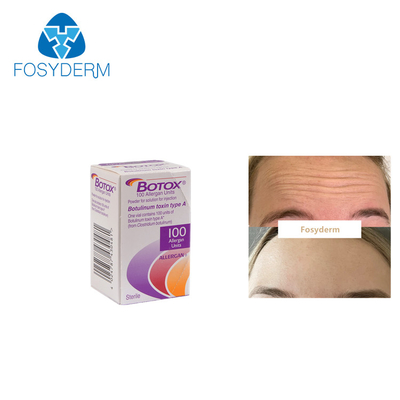 Yüz Kırışıklıklarını Kaldırmak İçin 100Units Allergan Botulinum Toxion  Tip A