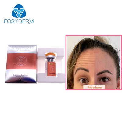 100 Adet Tip A Botulinum Toksin Allergan Yüz Kırışıklıklarına Karşı Botoks Botulax Enjeksiyonu