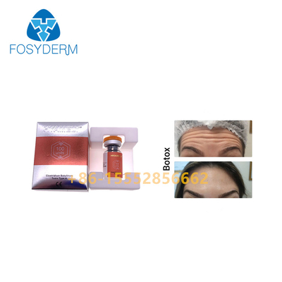 100 adet TypeA Botulinum Toksin Enjeksiyonu Kırışıklık Karşıtı  Allergan