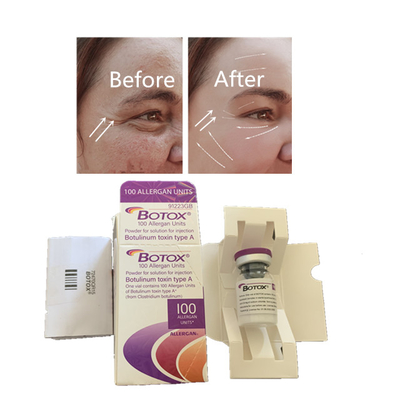 Kırışıklık azaltma 100 Birim Allergan Botox Enjeksiyon Yüzün ince çizgilerini ortadan kaldırır