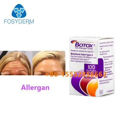 100 birim botulinum toksin alergen yüz kırışıklıklarını kaldırın enjekte A tipi botoks