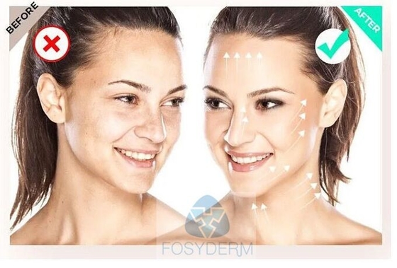 Dolgulu  135 HA Mezoterapi Serumu FILORGA 5*3ml Cilt Güçlendirici Gençleştirme