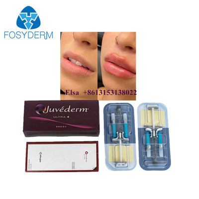 Juvederm Enjekte edilebilir Dermal Filler Juvederm Ultra3 Ultra4 Voluma