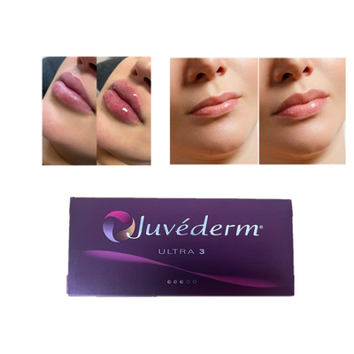 Juvederm Hyaluronik Asit Dermal Filler Kırışıklık Karşıtı Yüz Dudak Dolgusu