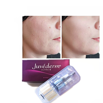 Juvederm Hyaluronik Asit Dermal Filler Yaşlanma Karşıtı 2*1ml Yüz Dolgusu