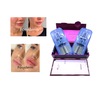 Juvederm Hyaluronik Asit Dermal Filler Yaşlanma Karşıtı 2*1ml Yüz Dolgusu