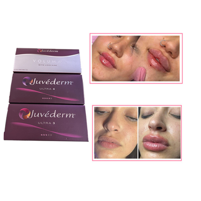 Deri Bakım Enjeksiyonları Dudak Plumper Juvederm Hyaluronik Asit Yüz için Dermal Filler