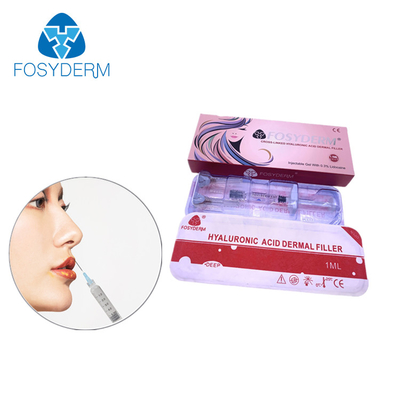 2ml Hyaluronik Asit Dermal Dolgu Yüzün Çene Çene Dudaklar Ve Vücut Üzerindeki Kıvrımları Yumuşatmak İçin