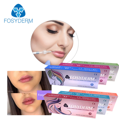 2ml Hyaluronik Asit Dermal Dolgu Yüzün Çene Çene Dudaklar Ve Vücut Üzerindeki Kıvrımları Yumuşatmak İçin