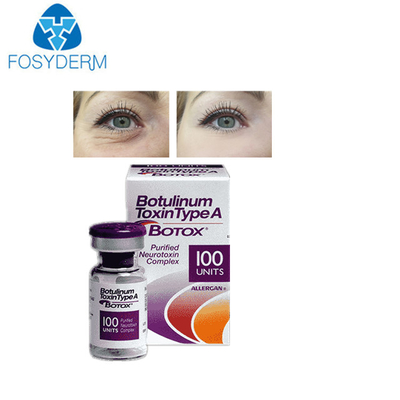 Botulinum Toxin kırışıklık önleyici enjeksiyon