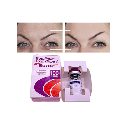 Botulinum Toxin kırışıklık önleyici enjeksiyon