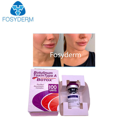 2 Yıllık Kalıcılık Süresi Botulinum Toxin For Anti Wrinkle Treatment
