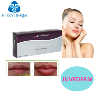 Juvederm Hyaluronik Asit Dermal Filler Seksi Dudaklar 24MG Yüz Filler için