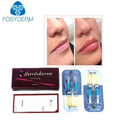 Juvederm Hiyalüronik Asit Dermal Dolgu Yüz için Anti Kırışıklık Enjeksiyonu