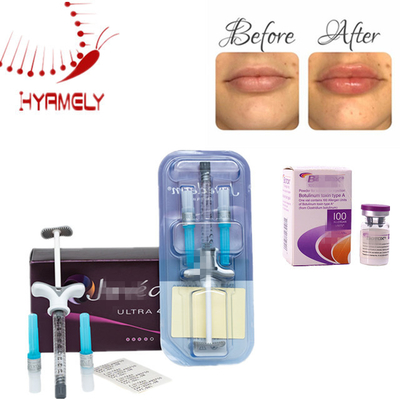 Allergan Enjeksiyon Botulinum Toksin Kırışıklık Karşıtı Yüz ve Boyun Kırışıklıklarını Azaltma Amaçlı Dermal Dolgu