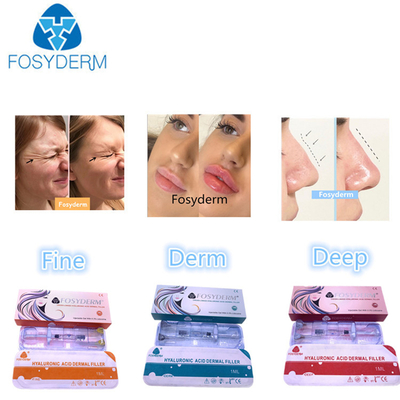 Hyaluronik Asit Dermal Filler 1ml-50ml Yüz ve Vücut için