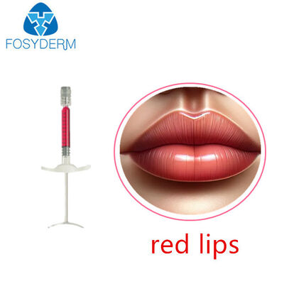 1ml Red Lips Filler Hyaluronic Acid Injectable Dermal Filler