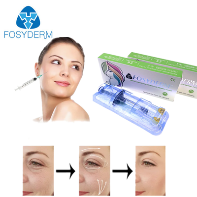 Yüz Gençleştirme HA Dermal Dolgu Maddesi Yüz Çene Yanak Dudak Vücut Canavar Kalça