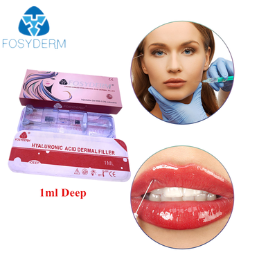 Cross‑Linked Hyaluronic Acid Dermal Filler Anti‑Wrinkle Lip Enhancement
