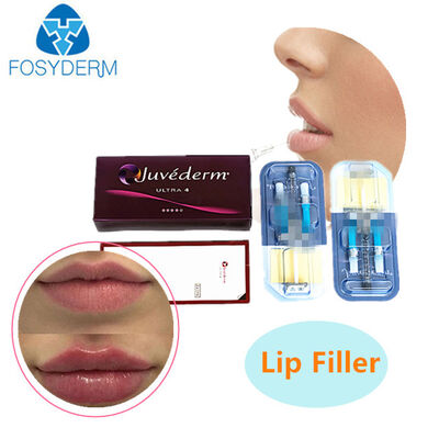 Dudak ve Yüz Hacmi Kırışıklığı İçin Juvederm Hyaluronik Asit Enjekte Edilebilir Dermal Dolgu