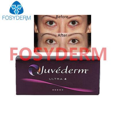 Dudak ve Yüz Hacmi Kırışıklığı İçin Juvederm Hyaluronik Asit Enjekte Edilebilir Dermal Dolgu