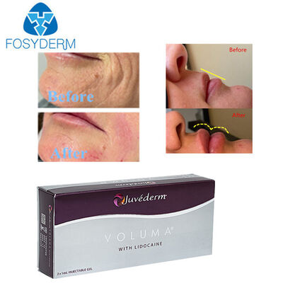 Juvederm Hyaluronic Acid Dermal Filler Face Lifting Nose Up 2ml
