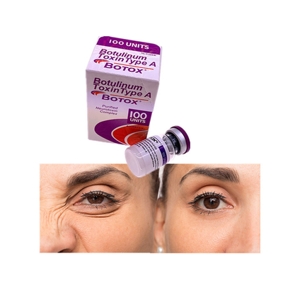 Alın Kırışıklıkları İçin Enjekte Edilen Allergan  Botulinum Toksin 100 Adet