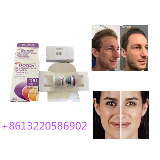 Yaşlanma Karşıtı Allergan  Enjeksiyonu 100 Adet Tip A Kırışıklık Karşıtı