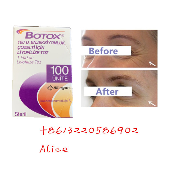 Yaşlanma Karşıtı Kırışıklık Karşıtı Botulinum Toksin Allergan Tip A Botoks Tozu