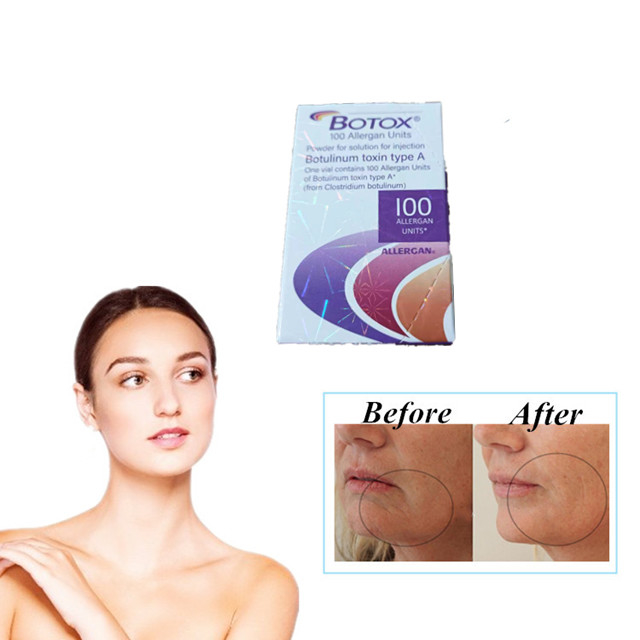Allergan  100 Adet Çeşitleri Botulinum Toksin Enjeksiyonu Kırışıklık Karşıtı