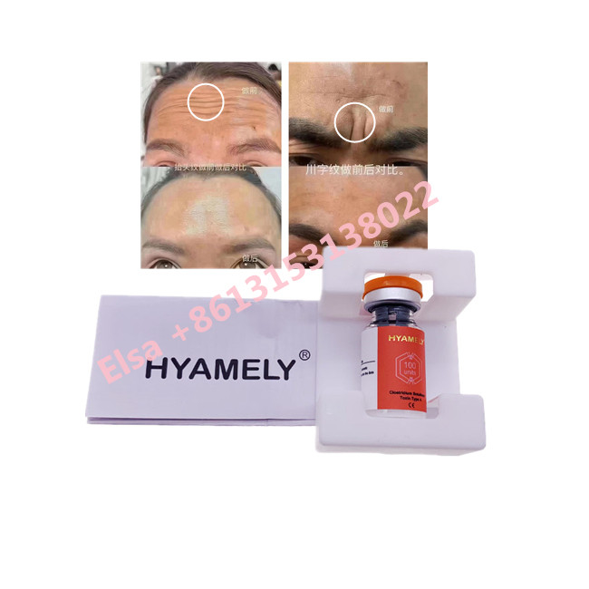 Hyamely  Botulinum Toxin Type A Korean  100u Kozmetik