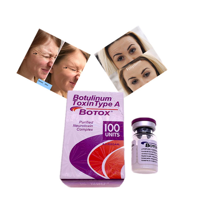 Allergan Botulinum Toxin Type A  100 Unit Dermal Dolgu Hyaluronik Asit