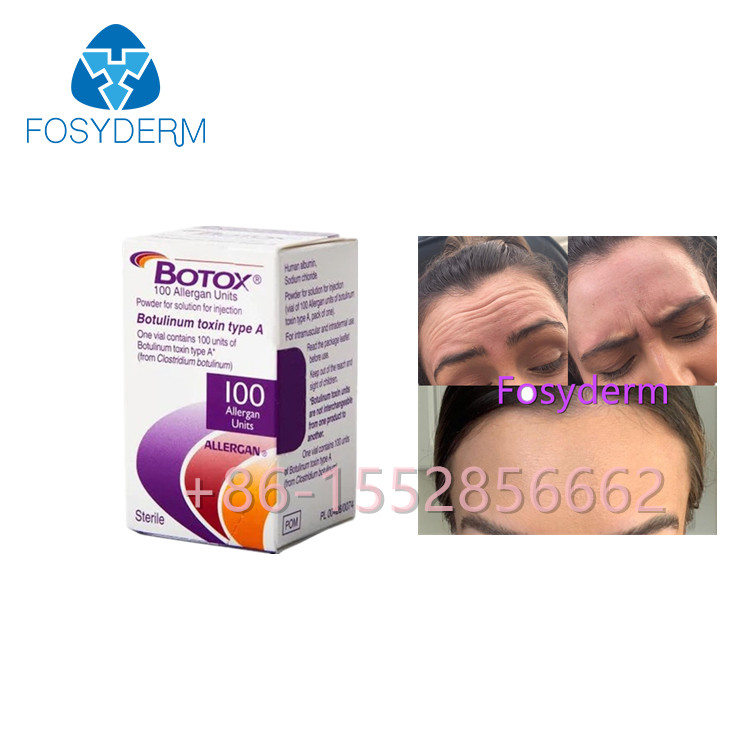 Allergan  100 Ünite Botulinum Toksin Kırışıklık Karşıtı Tip A Enjeksiyonu