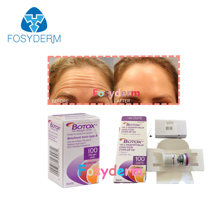 100 Adet Botulinum Kırışıklık Karşıtı Toksin Allergan Enjeksiyonu TypeA