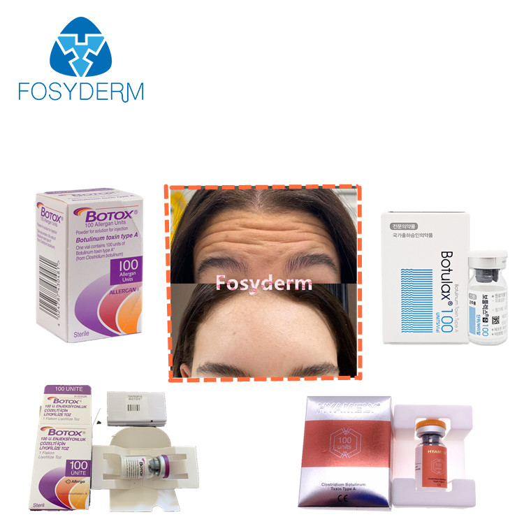 100 adet TypeA Botulinum Toksin Enjeksiyonu Kırışıklık Karşıtı  Allergan