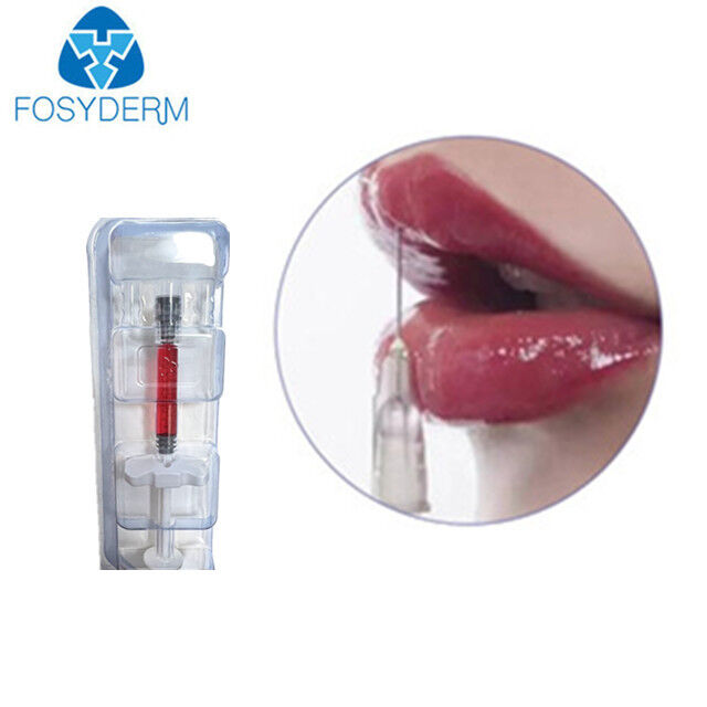 B12 Vitamini ile Dudak Hacmi 1ml 24mg/Ml Dermal Dolgu Hyaluronik Asit Kırmızı Dudak Dolgusu