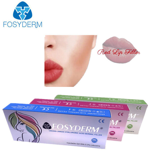 1 ml 2 ml Hyaluronik Asit Dermal Filler Anti- kırışıklık dudak büyütme 24 mg