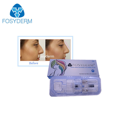 Burun Çene Jawline CE Onaylı Çapraz Bağlantılı Enjekte Edilebilir HA Derin Dermal Dolgu